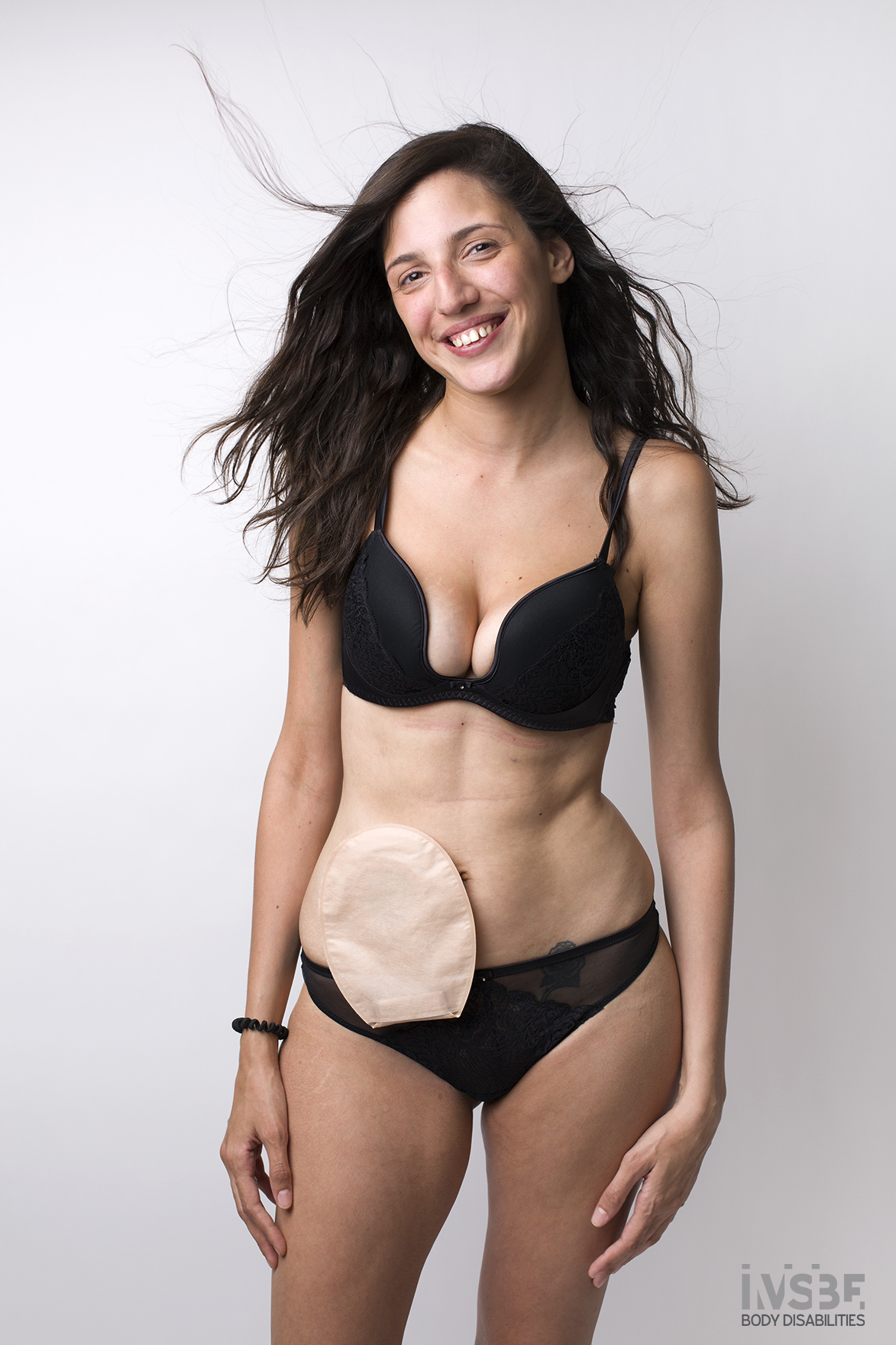 invisible body disabilities